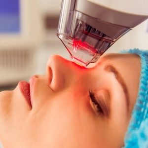 Laser Treatment for Face