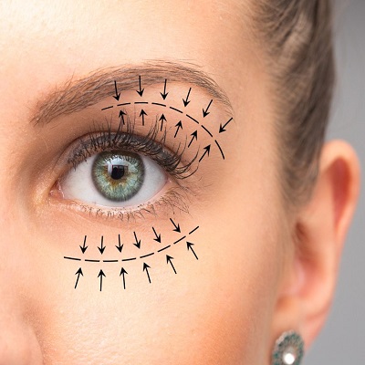 Brow Lift Surgery in Islamabad
