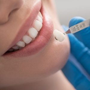 5 Different Types of Dental Crowns in Islamabad