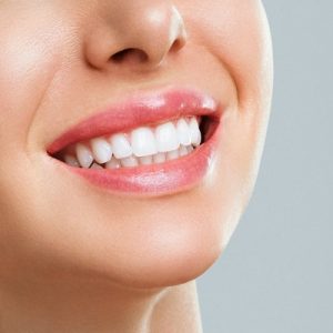 Price of Teeth Whitening in Islamabad