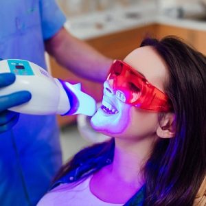 How much does laser teeth whitening cost in Islamabad?