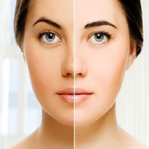 How much full body whitening cost in Rawalpindi Islamabad