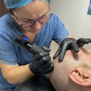 How long does micro scalp pigmentation last?