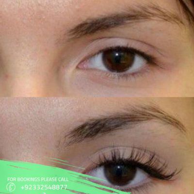 Eyelash extension treatment cost in Islamabad