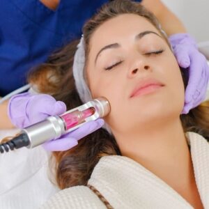 The Pros and Cons of Laser Acne Therapy: What to Consider
