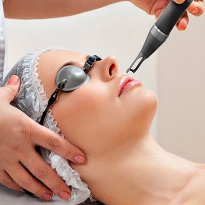 Pico Laser Treatment Cost in Islamabad