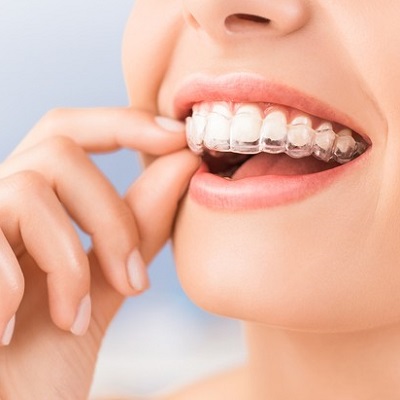 How is the Invisalign treatment different from other teeth straightening options?