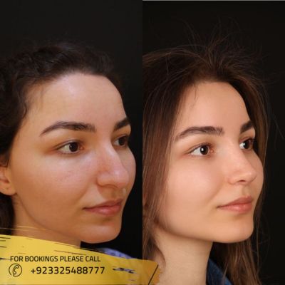 Images of Magic facelift in Islamabad