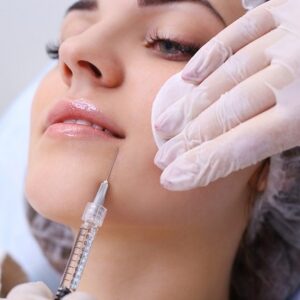 Dermal Filler in Islamabad For Smile Lines