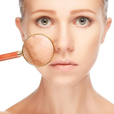 How To Maximize The Benefits Of Pigmentation Treatment in Islamabad?