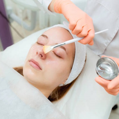 Can I Go To Work After A Chemical Peel in Islamabad?