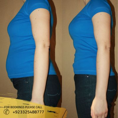 Images of weight loss treatment in Islamabad