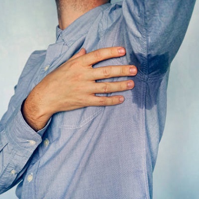 Is there any treatment for excessive sweating in Islamabad?