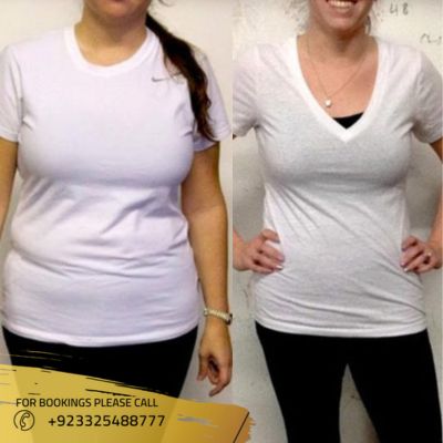 Results of weight loss treatment in Islamabad