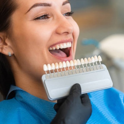 What happens before dental veneer placement?