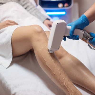 Which Is Better for Hair Removal Diode Laser Or IPL?