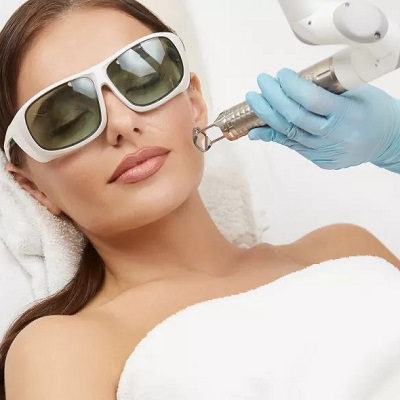 Which Laser Is Best for Scar Removal in Islamabad?
