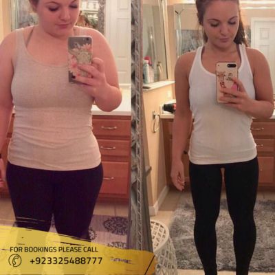 before after of weight loss treatment in Islamabad