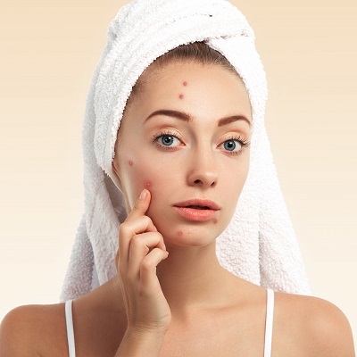 Can acne scars be cured completely?