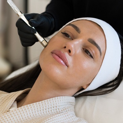 How Many Layers Does Microdermabrasion Remove?