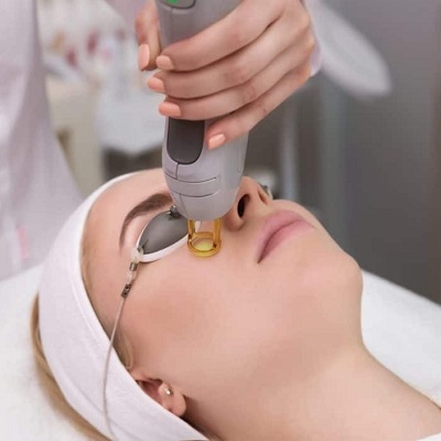 How long does pico laser in Islamabad take to heal?