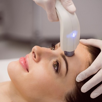 Which acne scars does laser resurfacing treat?