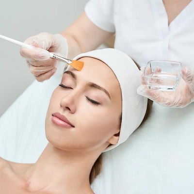 Are There Different Types of Chemical Peels in Islamabad?