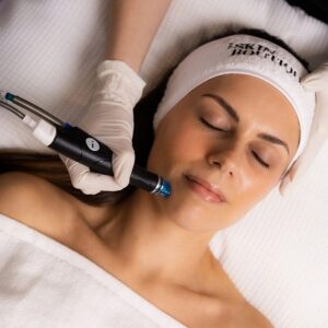 Does HydraFacial in Islamabad remove dark spots?