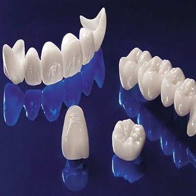 What Is the Cost of Zirconia Crown in Islamabad?