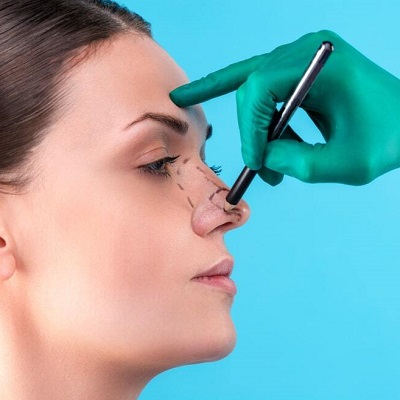 How Much Does Rhinoplasty Cost in Islamabad?