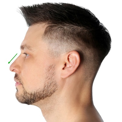 What Are the Key Considerations for Male Rhinoplasty?