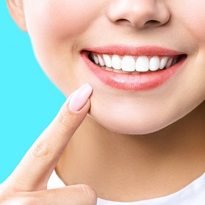 Best Clinic for Teeth Whitening in Islamabad