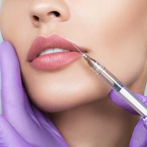 Which Type of Lip Filler is Right for You?